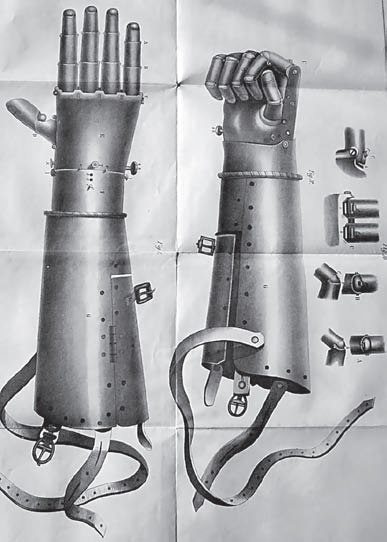 Общий вид протеза Гёца фон Берлихингена с распрямленными и сжатыми пальцами